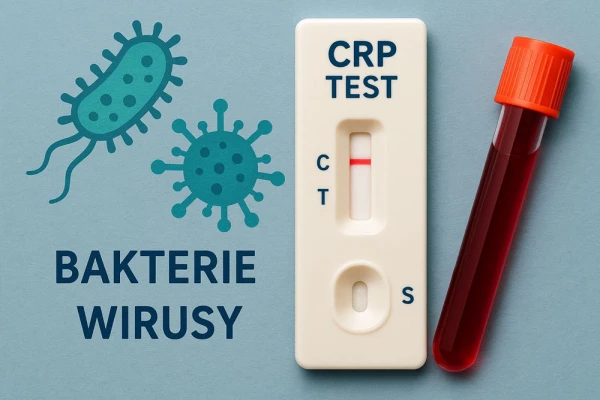 Test CRP – kiedy go użyć i jak odróżnić infekcję bakteryjną od wirusowej?